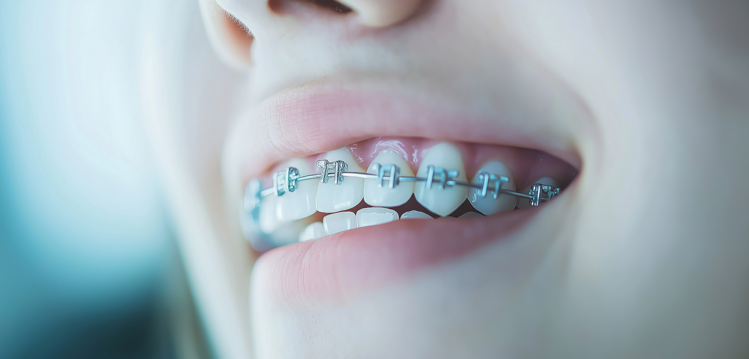 美しい歯並びは一生の財産です